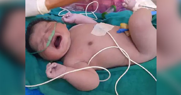 इंदौर में मप्र की सबसे वजनी नवजात ने लिया जन्म, 5.43KG की बच्ची ने तोड़ा रिकॉर्ड, मंडला को पछाड़ा